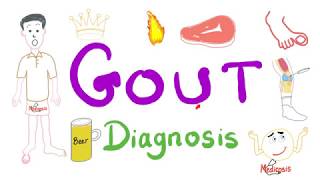 Gout Diagnosis [upl. by Alden]