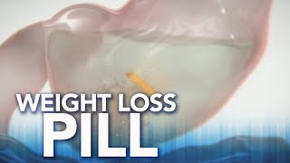 FDA approves new weight loss pill [upl. by Asset]