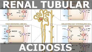 Renal Tubular Acidosis [upl. by Cavill]