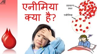 Anemia Causes Types Symptoms Diet and Treatment in Hindi  How to cure anemia at home in Hindi [upl. by Nidnarb289]