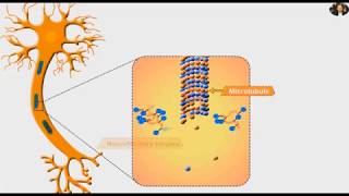 Neurofibrillary tangles and Tau protein Alzheimer [upl. by Gniliem]